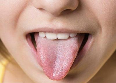 کشف سلول های چشایی که تمام طعم ها را می شناسند