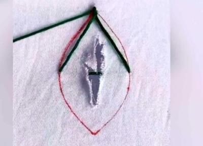 چطور پارچه پاره شده را رفو کنیم؟