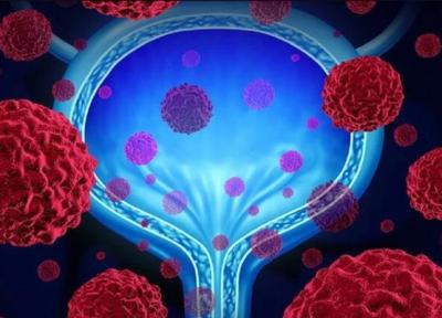 5 راه حل برای سم زدایی مثانه